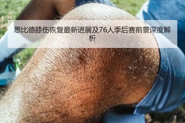 恩比德膝伤恢复最新进展及76人季后赛前景深度解析